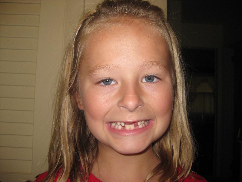 IMG_0869.JPG - Sydney started losing things this summer ... namely, her teeth!